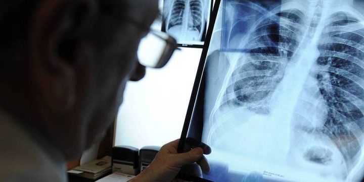 Незначительный рост заболеваемости пневмонией зафиксировали в Свердловске