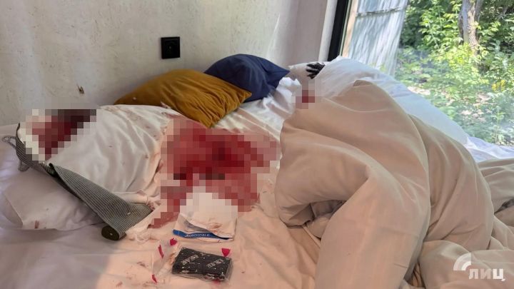 Оторвало кисть, осколок попал в шею: в глэмпинге в Луганске, атакованном БПЛА, праздновали девичник