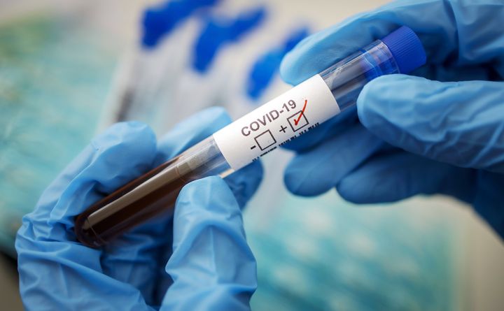 За неделю в ЛНР выявили более 80 случаев заражения COVID-19