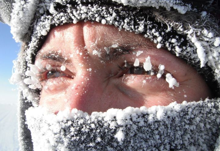 В ЛНР за прошедшие сутки зафиксировано три серьёзных случая обморожения
